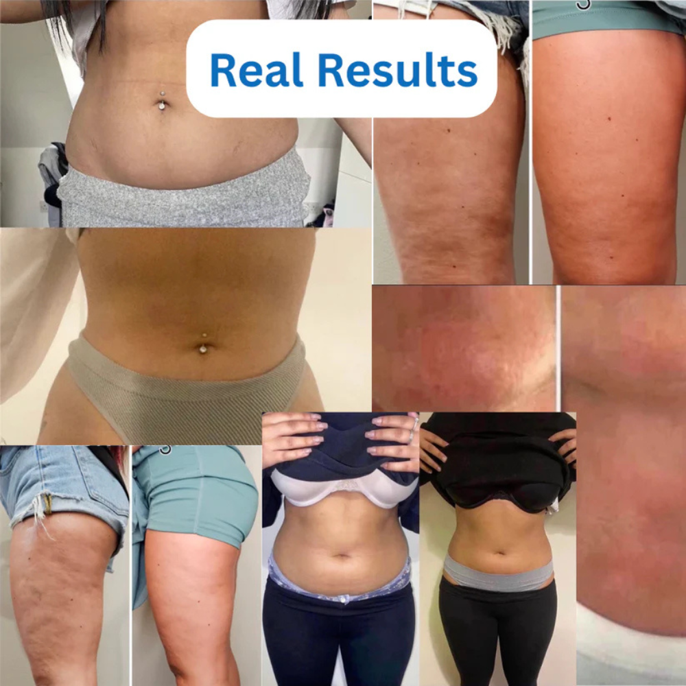 SlimQuick Ultrasonic Cavitation Machine