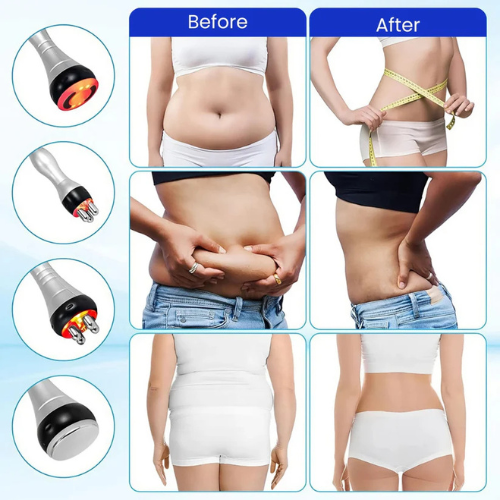 SlimQuick Ultrasonic Cavitation Machine